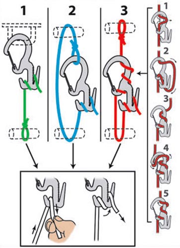 \"nite-ize-fig-9-knots-sm.jpg\"